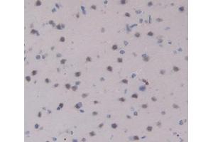 Used in DAB staining on fromalin fixed paraffin- embedded Kidney tissue (IL17RA 抗体  (AA 617-847))