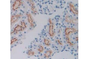 #VALUE! (SIRPA 抗体  (AA 56-296))