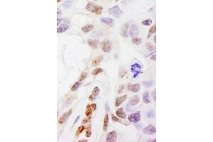 Immunohistochemistry (IHC) image for anti-DEAH (Asp-Glu-Ala-His) Box Polypeptide 38 (DHX38) (AA 1150-1200) antibody (ABIN7454376)