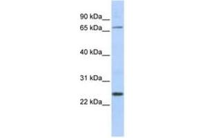 ZNF835 Antikörper  (AA 306-355)