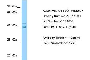 Western Blotting (WB) image for anti-Ubiquitin-Conjugating Enzyme E2Q Family Member 1 (UBE2Q1) (Middle Region) antibody (ABIN2789307) (UBE2Q1 抗体  (Middle Region))