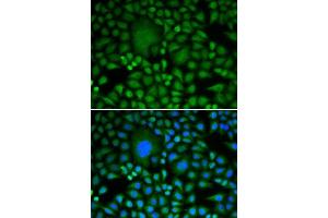 Immunofluorescence analysis of HeLa cells using DDX5 antibody. (DDX5 抗体  (AA 1-614))