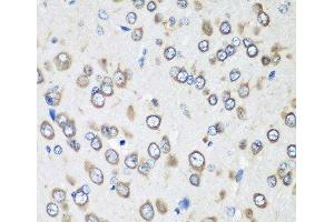 Immunohistochemistry of paraffin-embedded Rat brain using EEF1G Polyclonal Antibody at dilution of 1:100 (40x lens). (EEF1G 抗体)