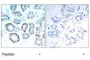 Image no. 1 for anti-BCL2-Like 11 (Apoptosis Facilitator) (BCL2L11) (Ser65) antibody (ABIN197552) (BIM 抗体  (Ser65))