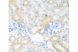Immunohistochemistry of paraffin-embedded Mouse kidney using CEACAM7 Polyclonal Antibody at dilution of 1:100 (40x lens). (CEACAM7 抗体)