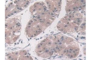 Immunohistochemistry (IHC) image for anti-Plasminogen Activator Inhibitor 1 (SERPINE1) antibody (ABIN7427915)