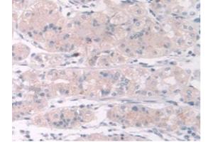IHC-P analysis of Human Stomach Tissue, with DAB staining. (TPMT 抗体  (AA 26-227))