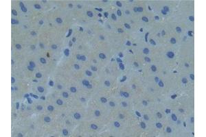 Immunohistochemistry (IHC) image for anti-Raftlin, Lipid Raft Linker 1 (RFTN1) (AA 288-520) antibody (ABIN7442279)
