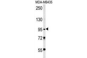 Western Blotting (WB) image for anti-Thyrotropin Releasing Hormone Degrading Enzyme (TRHDE) antibody (ABIN3002402) (TRHDE 抗体)