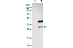Western blot analysis of Lane 1: Negative control (vector only transfected HEK293T lysate), Lane 2: Over-expression Lysate (Co-expressed with a C-terminal myc-DDK tag (~3. (ANKRD23 抗体)