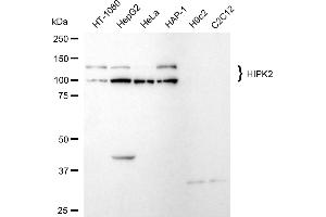 Western blotting analysis using HIPK2 antibody (ABIN7798997).