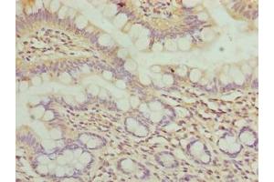 Immunohistochemistry of paraffin-embedded human small intestine tissue using ABIN7175786 at dilution of 1:100