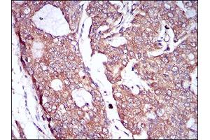 Immunohistochemistry (IHC) image for anti-Colony Stimulating Factor 1 Receptor (CSF1R) (AA 344-497) antibody (ABIN1724928)
