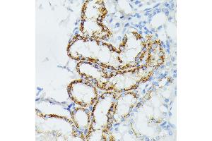Immunohistochemistry of paraffin-embedded mouse kidney using ETHE1 antibody (ABIN6131616, ABIN6140319, ABIN6140320 and ABIN6214289) at dilution of 1:100 (40x lens). (ETHE1 抗体  (AA 8-245))