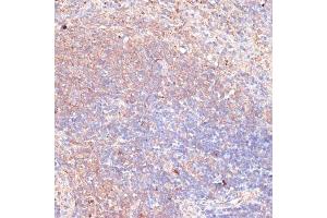 Immunohistochemistry of paraffin-embedded mouse spleen using TMX1 antibody  at dilution of 1:100 (40x lens).