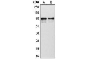 Western blot analysis of Cytochrome P450 1B1 expression in human tonsil (A), human liver (B) whole cell lysates.