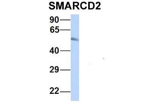 Host:  Rabbit  Target Name:  SMARCD2  Sample Type:  Human Fetal Heart  Antibody Dilution:  1. (SMARCD2 抗体  (Middle Region))