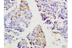 Formalin-fixed and paraffin embedded rat pancreas labeled with Anti-SGCB/SGC Polyclonal Antibody, Unconjugated  at 1:200 followed by conjugation to the secondary antibody and DAB staining. (SGCB 抗体  (AA 165-260))