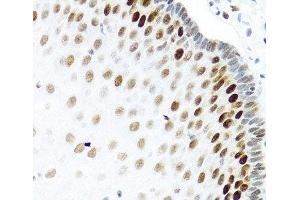 Immunohistochemistry of paraffin-embedded Human esophagus using KHDRBS2 Polyclonal Antibody at dilution of 1:100 (40x lens).