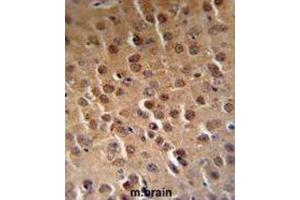 Immunohistochemistry (IHC) image for anti-Cyclin-Dependent Kinase 14 (CDK14) antibody (ABIN3002794) (CDK14 抗体)