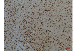 Immunohistochemistry (IHC) image for anti-Signal Transducer and Activator of Transcription 3 (Acute-Phase Response Factor) (STAT3) antibody (ABIN3188061)