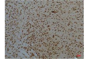 Immunohistochemistry (IHC) analysis of paraffin-embedded Mouse Brain Tissue using STAT3 Mouse Monoclonal Antibody diluted at 1:200. (STAT3 抗体)