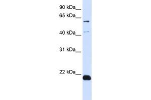 WB Suggested Anti-C14orf180 Antibody Titration:  0. (C14orf180 抗体  (N-Term))