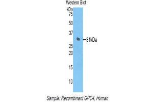 Western Blotting (WB) image for anti-Glypican 4 (GPC4) (AA 261-527) antibody (ABIN1859055) (GPC4 抗体  (AA 261-527))