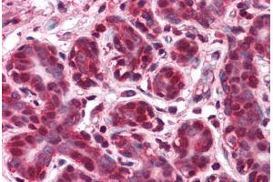 Human Breast: Formalin-Fixed, Paraffin-Embedded (FFPE) (BRE 抗体  (AA 9-338))