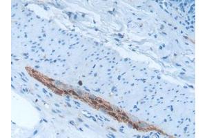 Used in DAB staining on fromalin fixed paraffin- embedded brain tissue (S100B 抗体  (AA 1-92))