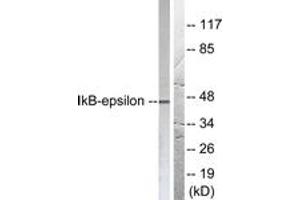 Western Blotting (WB) image for anti-Nuclear Factor of kappa Light Polypeptide Gene Enhancer in B-Cells Inhibitor, epsilon (NFKBIE) (AA 131-180) antibody (ABIN2888569) (NFKBIE 抗体  (AA 131-180))