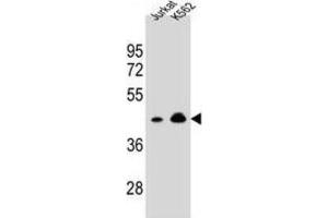 Western Blotting (WB) image for anti-Olfactory Receptor, Family 10, Subfamily A, Member 4 (OR10A4) antibody (ABIN2995885) (OR10A4 抗体)