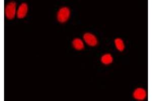 Immunofluorescent analysis of HP1 alpha staining in NIH3T3 cells. (CBX5 抗体  (Center))