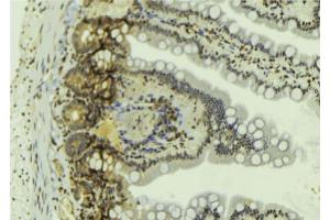 ABIN6269060 at 1/100 staining Mouse colon tissue by IHC-P. (JAK2 抗体  (C-Term))