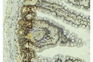ABIN6269060 at 1/100 staining Mouse colon tissue by IHC-P. (JAK2 抗体  (C-Term))