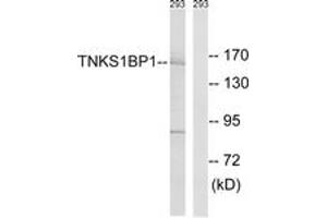 Western blot analysis of extracts from 293 cells, using TNKS1BP1 Antibody. (TNKS1BP1 抗体  (AA 1601-1650))