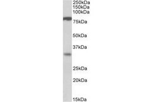 Antibody (1µg/ml) staining of Human Duodenum lysate (35µg protein in RIPA buffer). (CLCA1 抗体  (Internal Region))