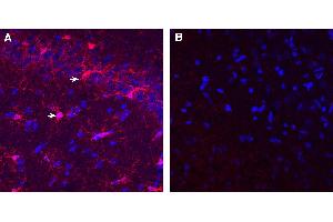 Expression of IBA1/AIF1 in rat hippocampusImmunohistochemical staining of perfusion-fixed frozen rat brain sections with Guinea Pig Anti-IBA1/AIF1 Antibody (ABIN7581823), (1:1000), followed by donkey anti-guinea pig-biotin and Streptavidin-Cy3.