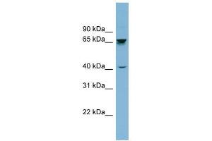 AChE antibody used at 1 ug/ml to detect target protein. (Acetylcholinesterase 抗体)