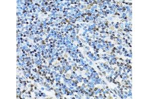 Immunohistochemistry of paraffin-embedded Human appendix using ITGB3BP Polyclonal Antibody at dilution of 1:100 (40x lens). (ITGB3BP 抗体)