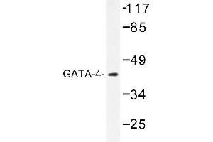 Image no. 2 for anti-GATA Binding Protein 4 (GATA4) antibody (ABIN272192) (GATA4 抗体)