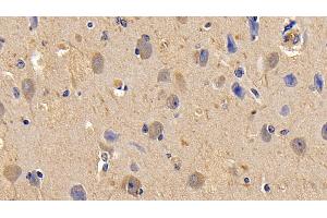 Detection of TNFa in Bovine Cerebrum Tissue using Polyclonal Antibody to Tumor Necrosis Factor Alpha (TNFa) (TNF alpha 抗体  (AA 71-234))