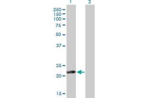 Western Blot analysis of ISOC2 expression in transfected 293T cell line by ISOC2 MaxPab polyclonal antibody. (ISOC2 抗体  (AA 1-205))