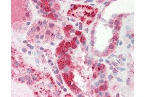 Immunohistochemistry (IHC) image for anti-CTD (Carboxy-terminal Domain, RNA Polymerase II, Polypeptide A) Small Phosphatase 2 (CTDSP2) (C-Term) antibody (ABIN6755323)