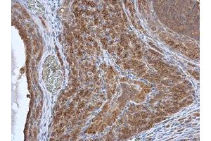 IHC-P Image HAX1 antibody detects HAX1 protein at cytoplasm in rat ovary by immunohistochemical analysis. (HAX1 抗体)