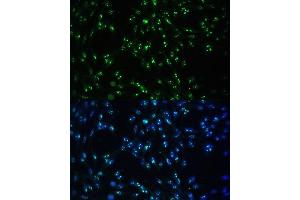 Immunofluorescence (IF) image for anti-Coiled-Coil Domain Containing 59 (CCDC59) (AA 1-241) antibody (ABIN7266440)