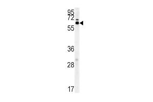 IKZF3 Antibody (Center) (ABIN651843 and ABIN2840420) western blot analysis in mouse liver tissue lysates (15 μg/lane). (IKZF3 抗体  (AA 76-103))
