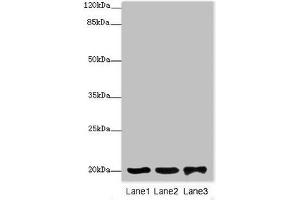 Western blot All lanes: FAIM antibody at 2 μg/mL Lane 1: 293T whole cell lysate Lane 2: Rat gonad tissue Lane 3: Jurkat whole cell lysate Secondary Goat polyclonal to rabbit IgG at 1/10000 dilution Predicted band size: 21, 25, 23 kDa Observed band size: 21 kDa (FAIM 抗体  (AA 1-179))