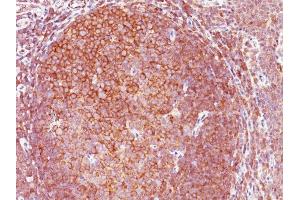 Formalin-fixed, paraffin-embedded human Tonsil stained with BCL10 Mouse Monoclonal Antibody (BL10/411). (BCL10 抗体  (AA 122-168))