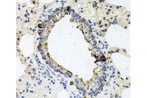 Immunohistochemistry of paraffin-embedded Rat lung using ERBB4 Polyclonal Antibody at dilution of 1:100 (40x lens). (ERBB4 抗体)